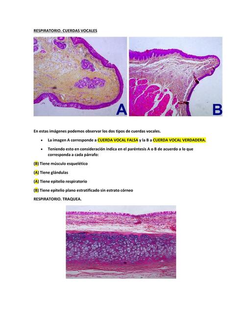 Respiratorio. Cuerdas Vocales 