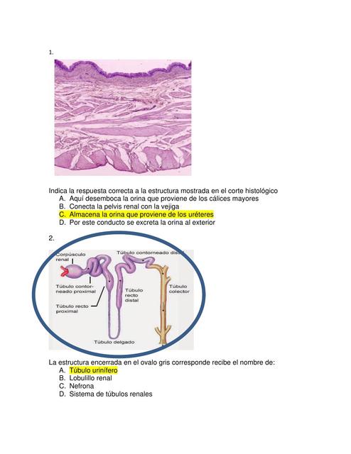 Tejido Urinario 
