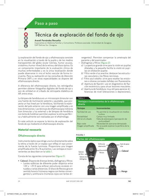 Técnica de exploración del fondo de ojo