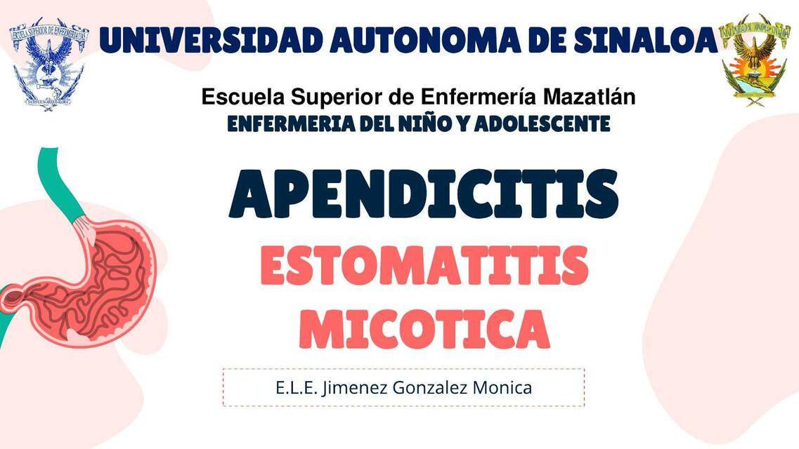 Apendicitis y estomatitis micótica