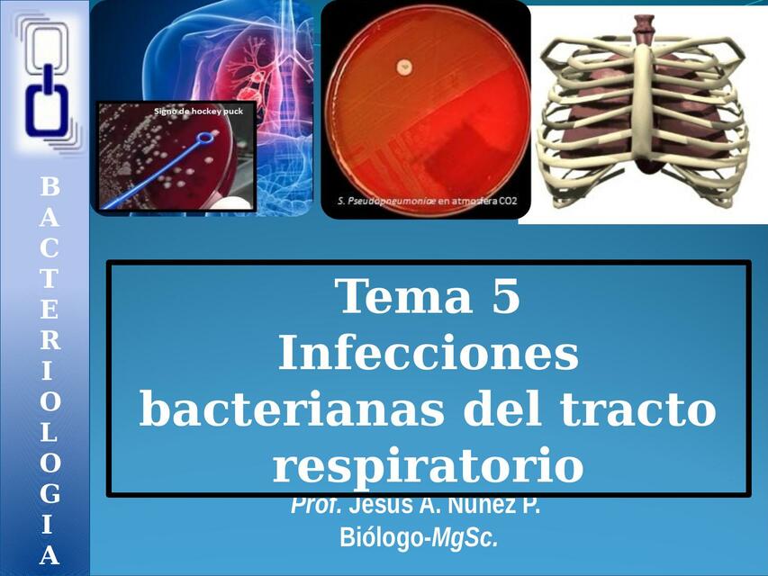 Infecciones Respiratorias 1