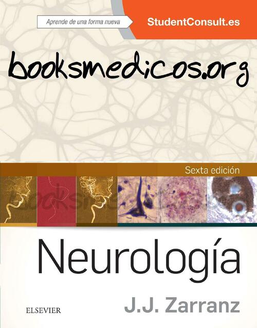 Neurología J.J. Zarranz 6a Edición 