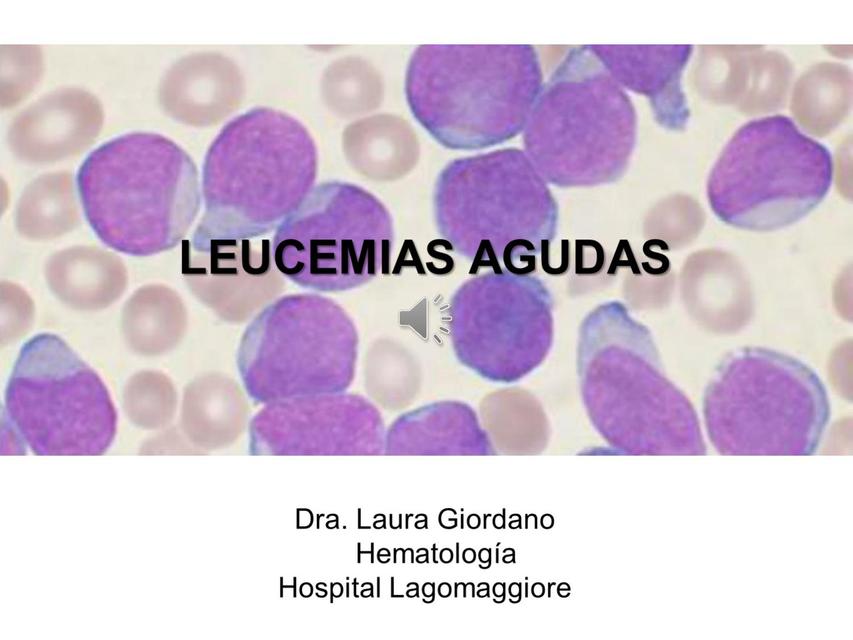 Leucemias agudas 