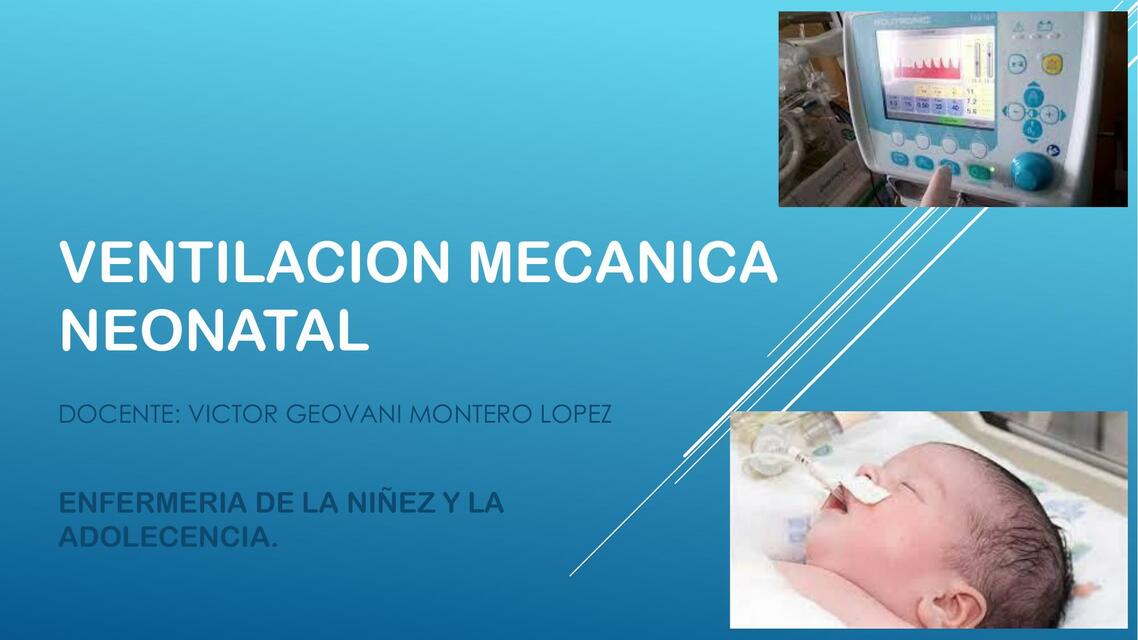 Ventilación mecánica neonatal