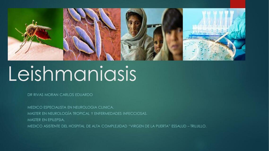 Leishmaniasis