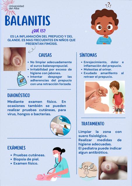 Flashcards de Balanitis | Por Anais AV | uDocz