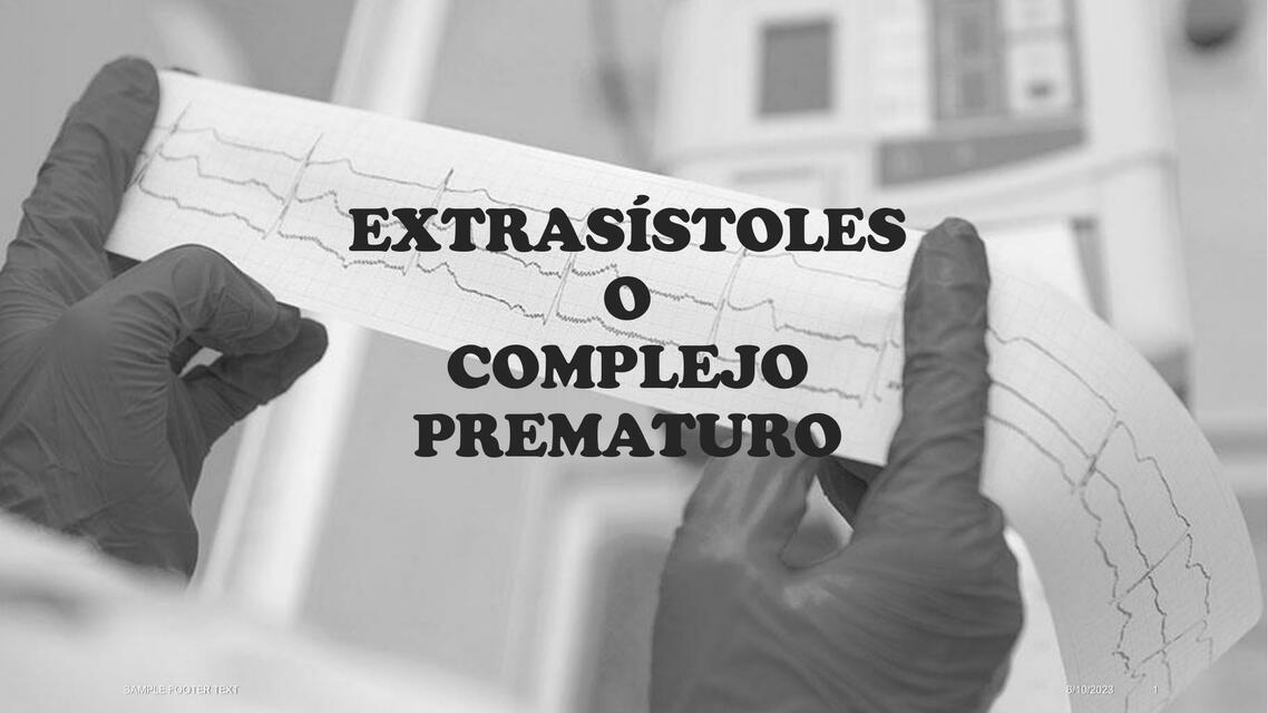 Extrasístoles