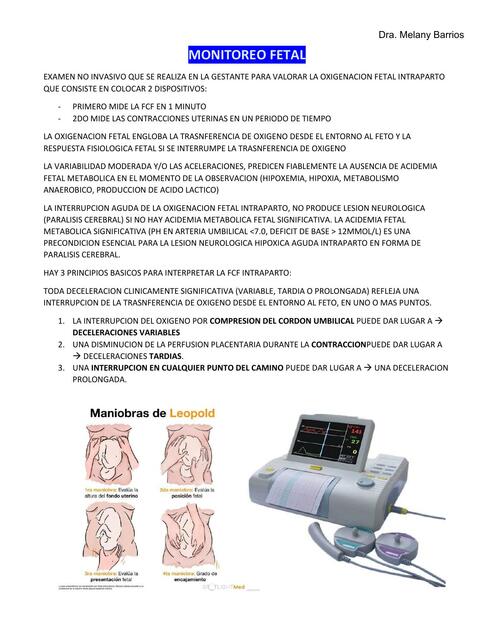 Resumen Monitorio  Fetal 