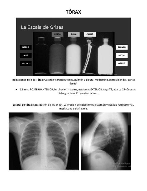 Tórax 