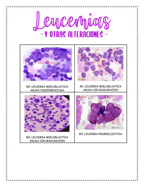 LEUCEMIAS Y ALTERACIONES ERITROCITARAS