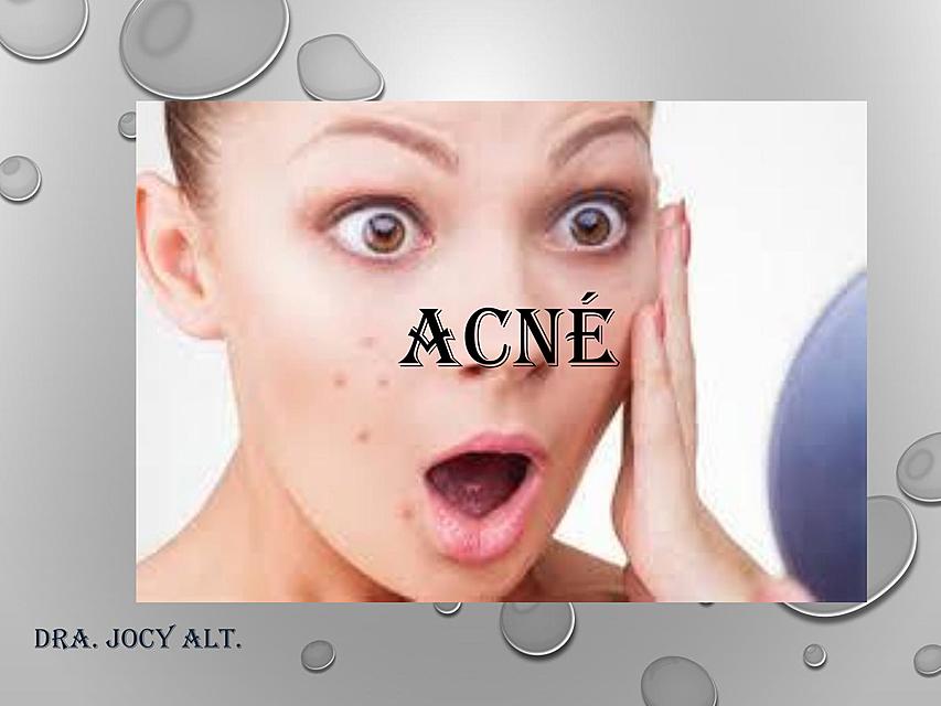 "Acné"