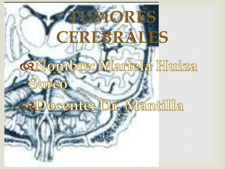 Tumores Cerebrales 