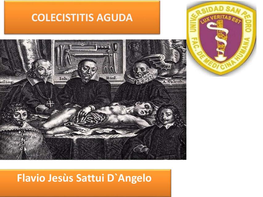 Colecistitis Aguda 