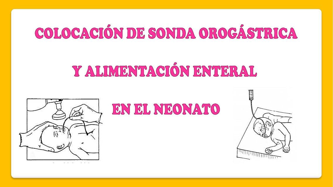 Sonda Orogastrica Em Rn - RETOEDU