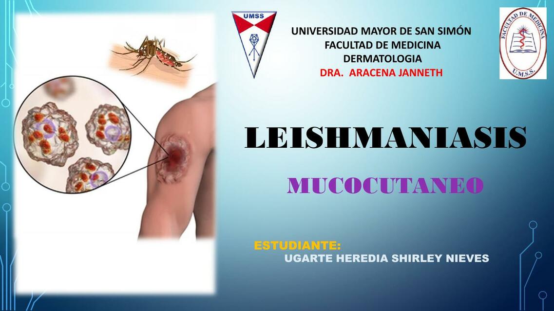 LEISHMANIASIS