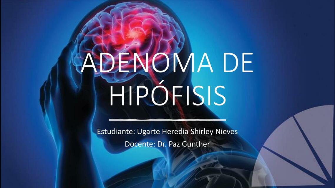 Adenoma de Hipófisis