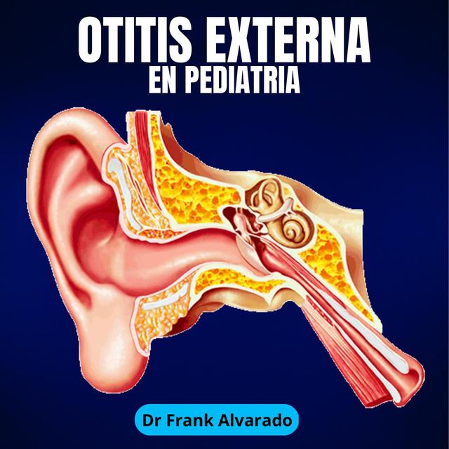 Otitis externa en pediatría Moisés Francisco Alvarado García uDocz