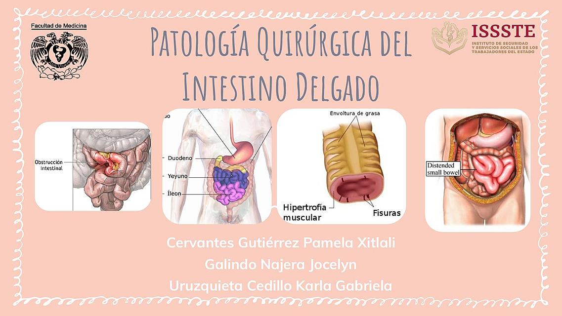 Patología Quirúrgica del Intestino Delgado