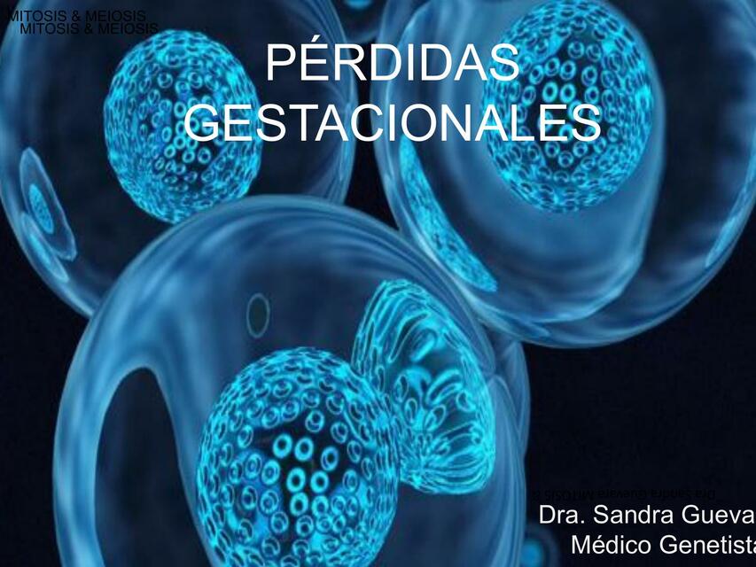 Pérdidas Gestacionales 