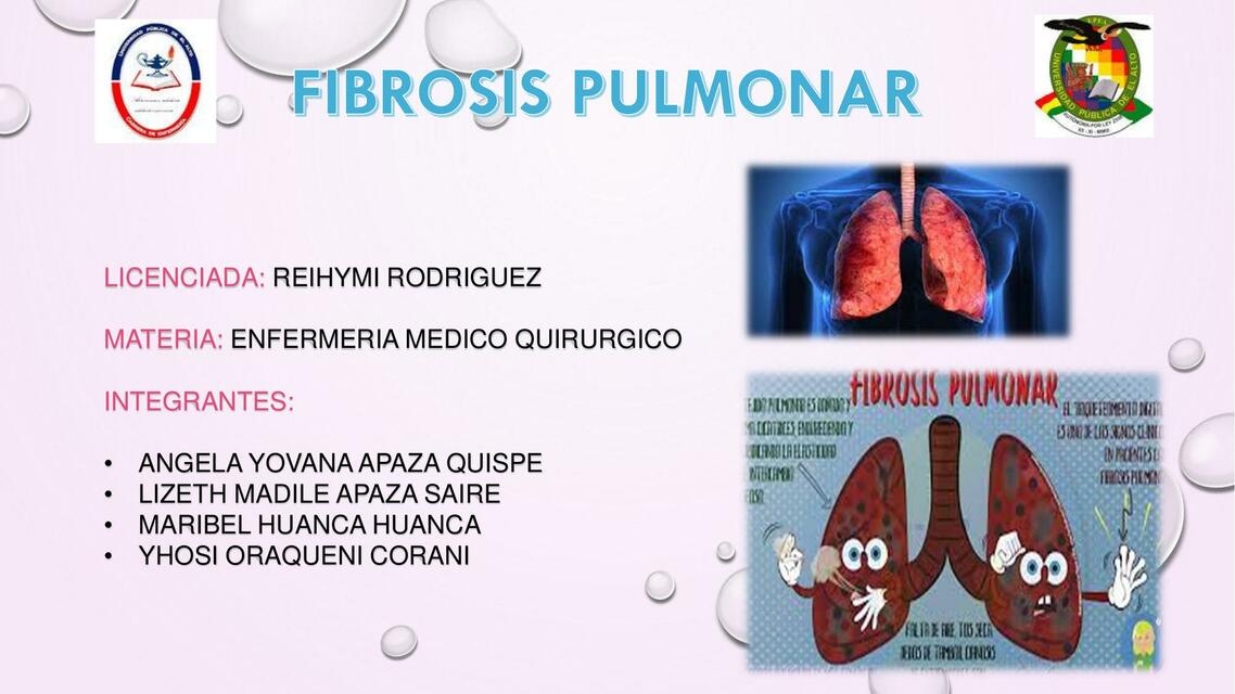 Fibrosis pulmonar completado