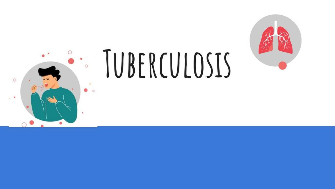 Tuberculosis pulmonar