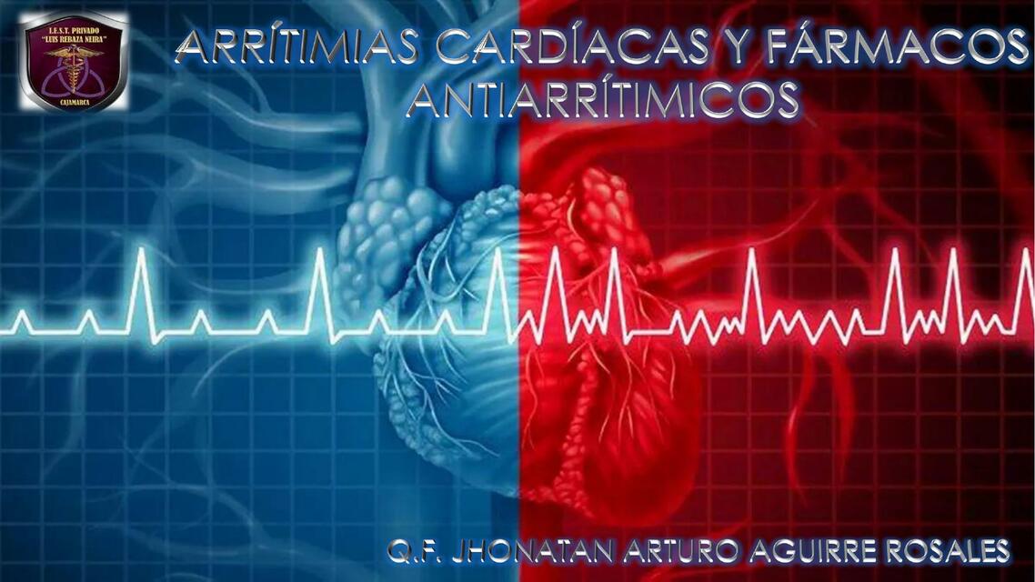 ARíTIMIAS CARDIÁCAS