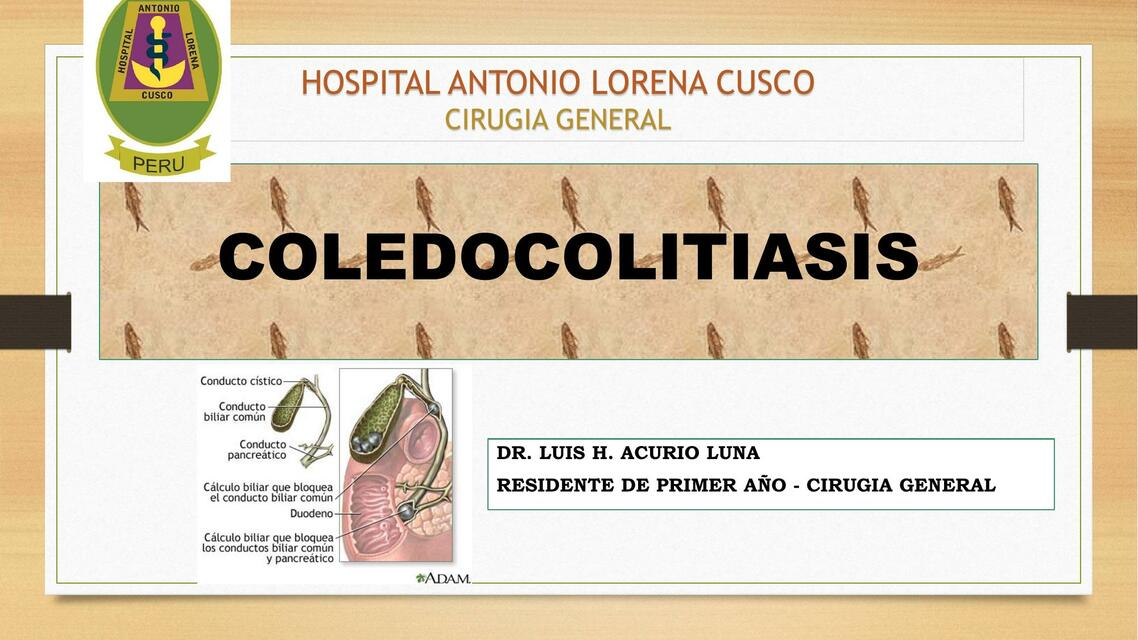 COLEDOCOLITIASIS