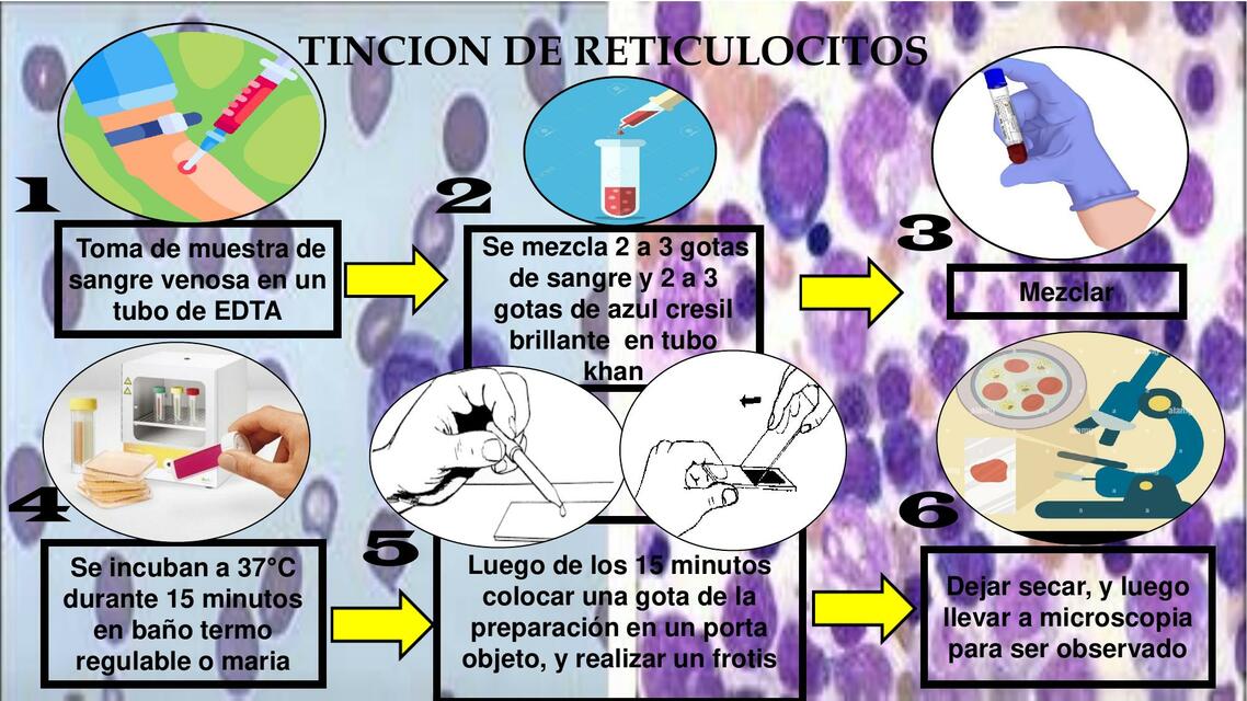 RETICULOCITOS | Daniela JaPi | uDocz