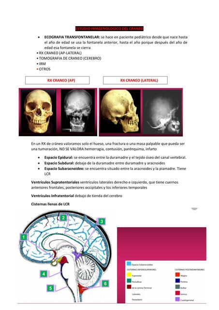 Estudio Imagenológico del Cráneo 