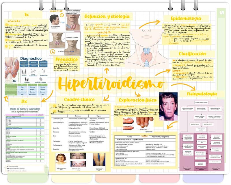 Hipertiroidismo resumen completo