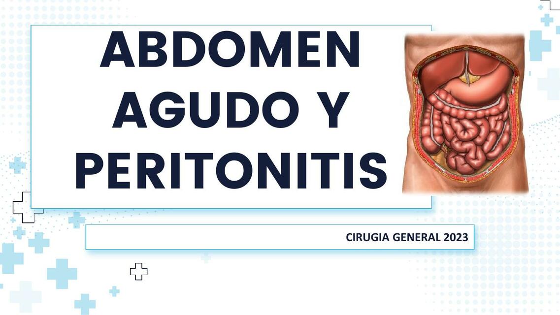 Abdomen agudo