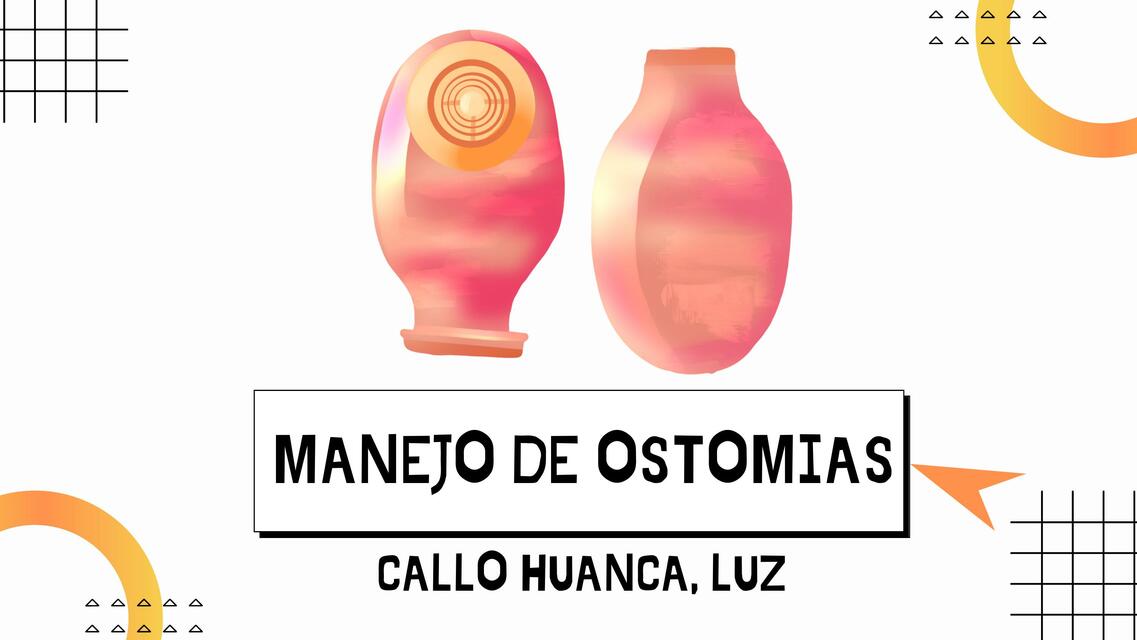 Manejo de ostomias