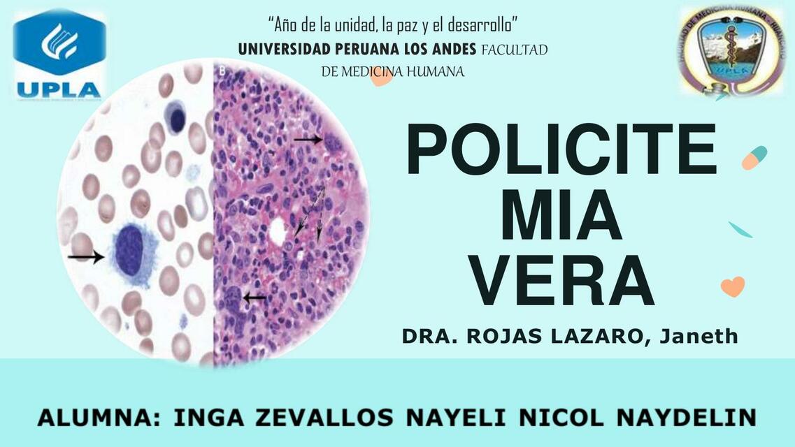 POLICITEMIA VERA