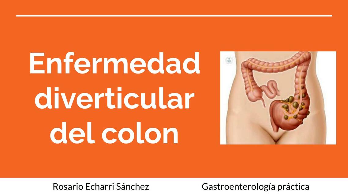 Enfermedad diverticular del colon