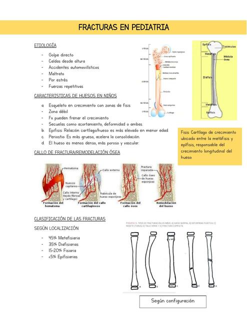 Fracturas en pediatria