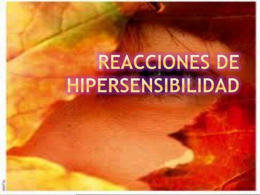 Reacciones de Hipersensibilidad 