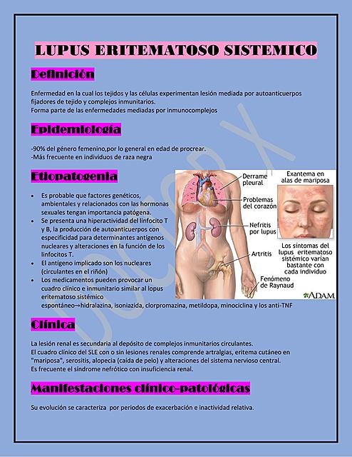 LUPUS ERITEMATOSO SISTEMICO