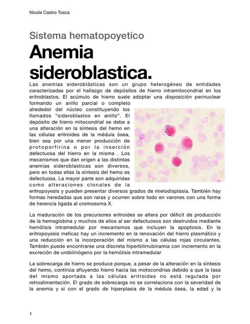 Anemia sideroblástica