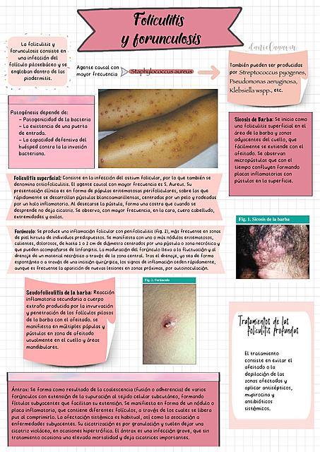 Foliculitus y forunculosis