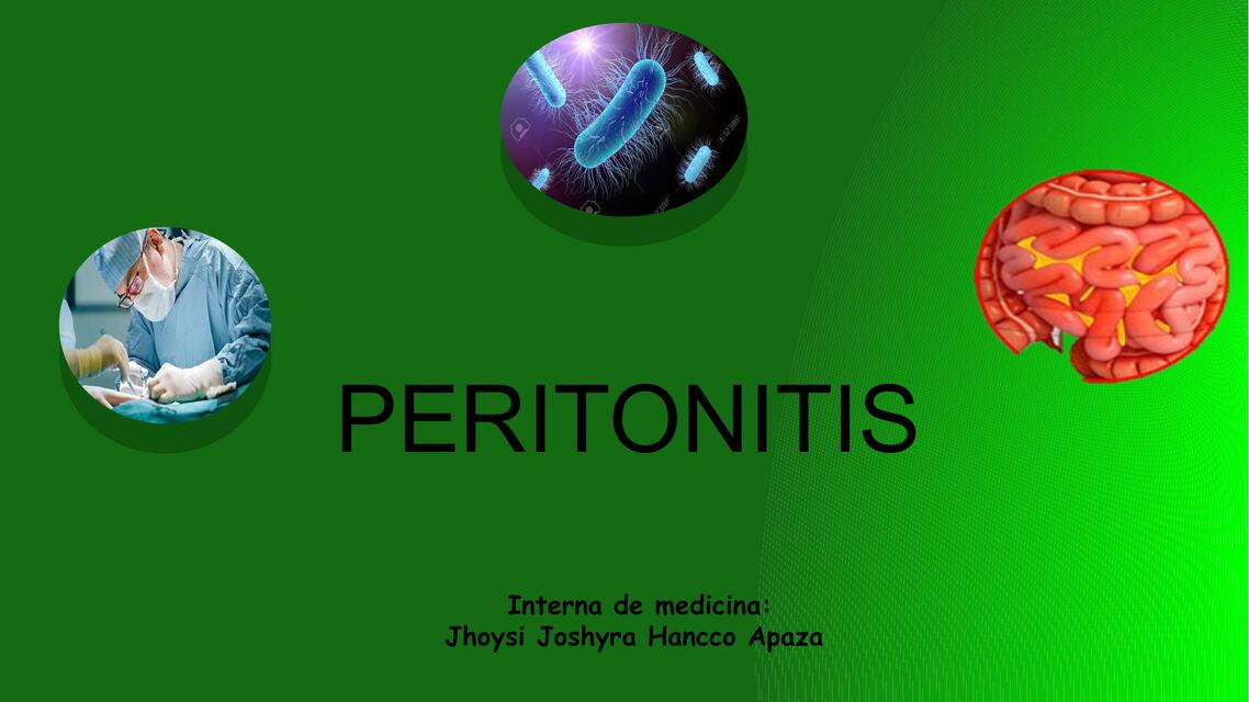 Peritonitis HANCCO