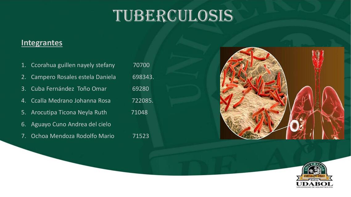 Tuberculosis 