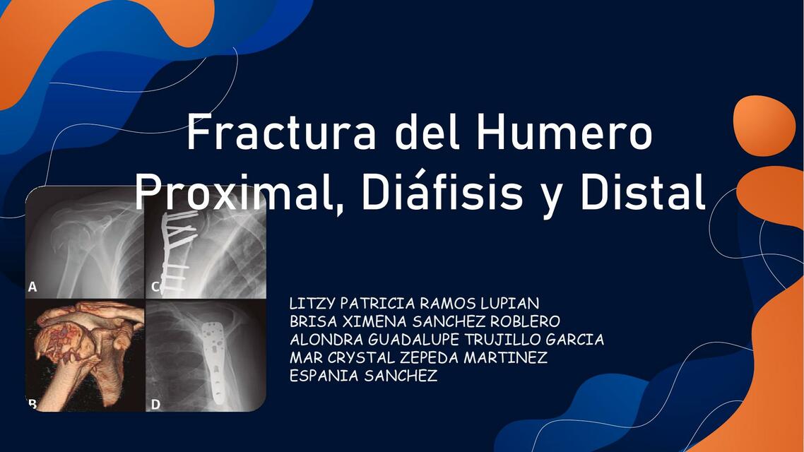 Fractura de Húmero