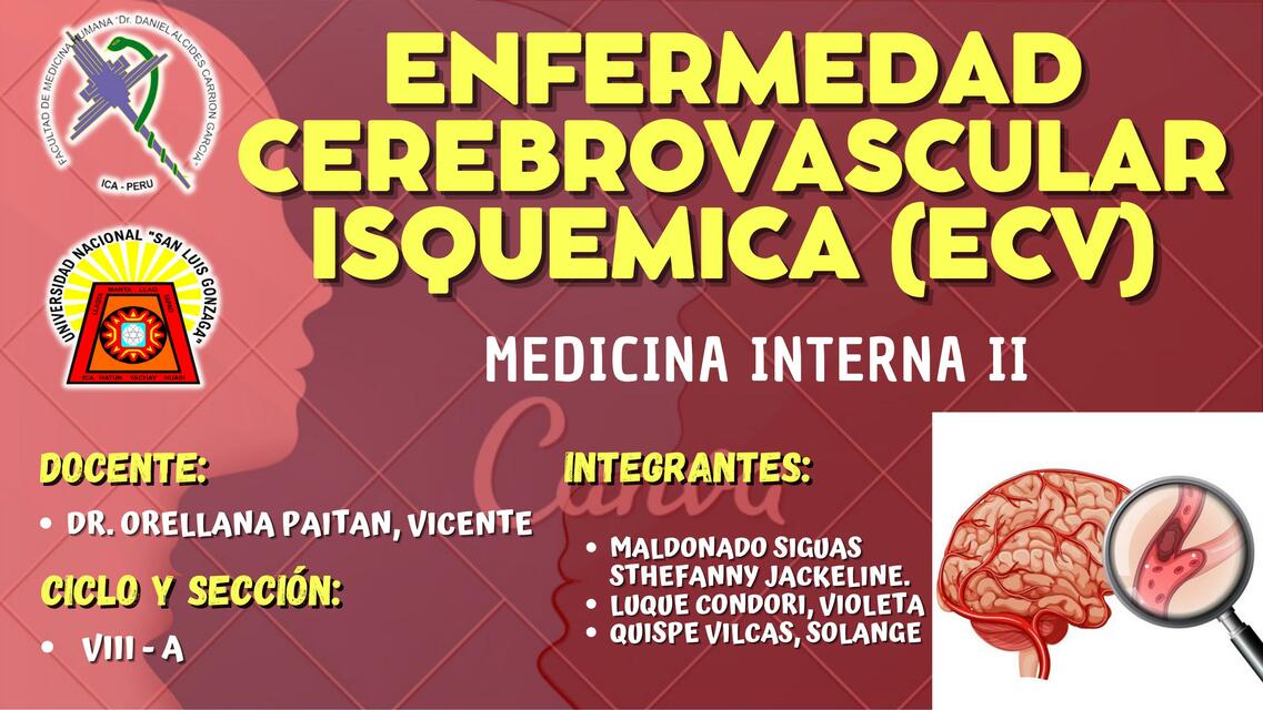 ECV Isquémico