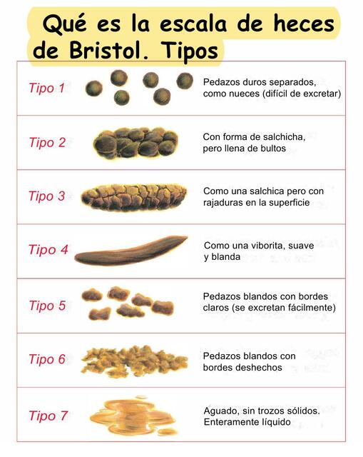 Bristol Escala Heces Qu Es La Escala De Bristol BYTKCK Bristol Escala Heces Qu Es La Escala De Bristol BYTKCK