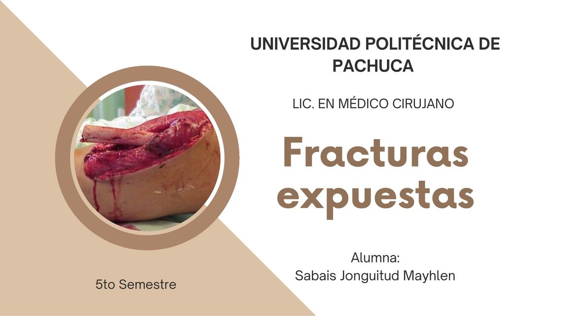 Fracturas expuestas