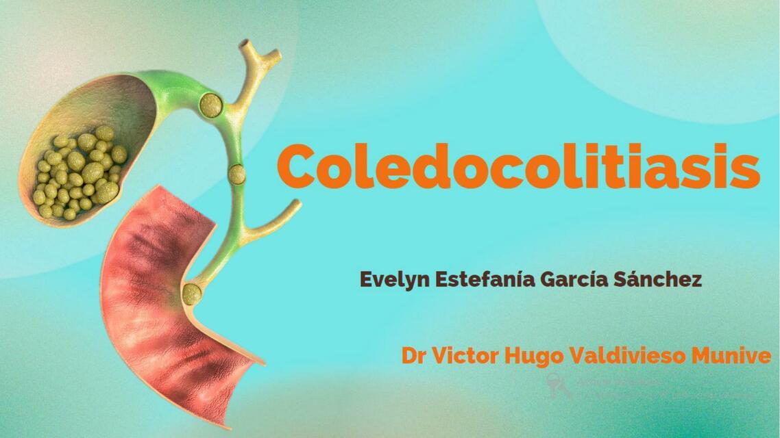 Coledocolitiasis