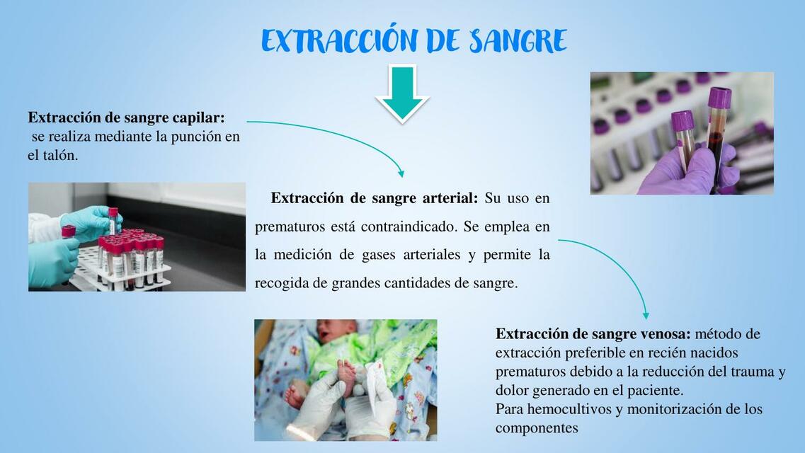 Extracción de sangre 