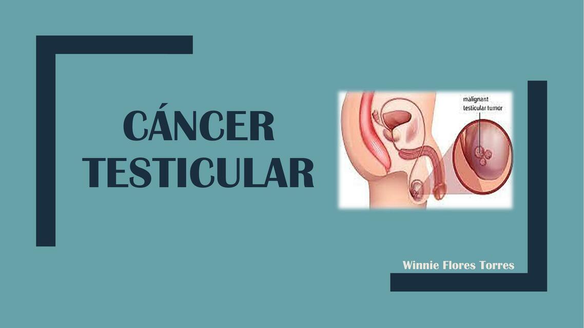 Cáncer Testicular