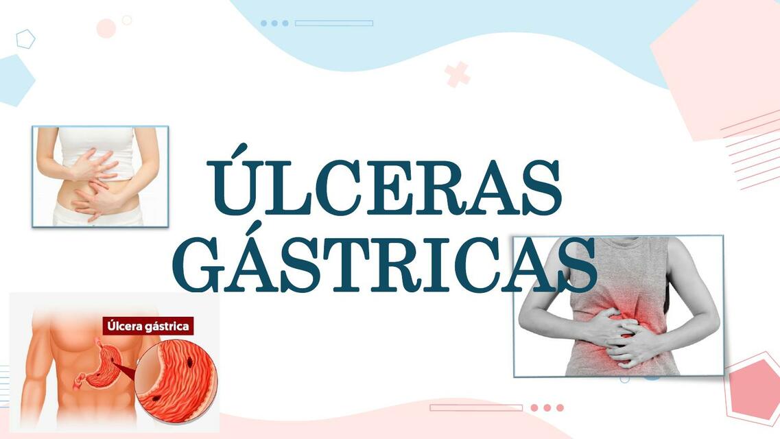 Úlceras Gástricas 