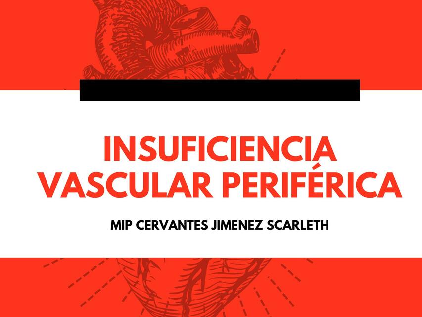 Insuficiencia Venosa Periférica 